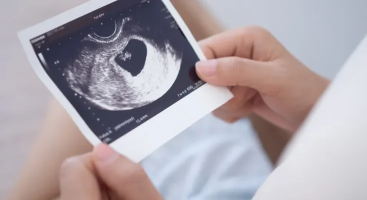 A woman holding an ultrasound photo of a fetus | Source: Shutterstock